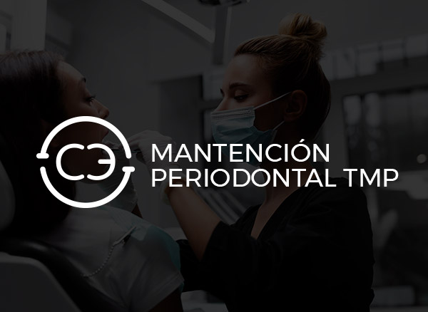 Mantención Periodontal (TMP)